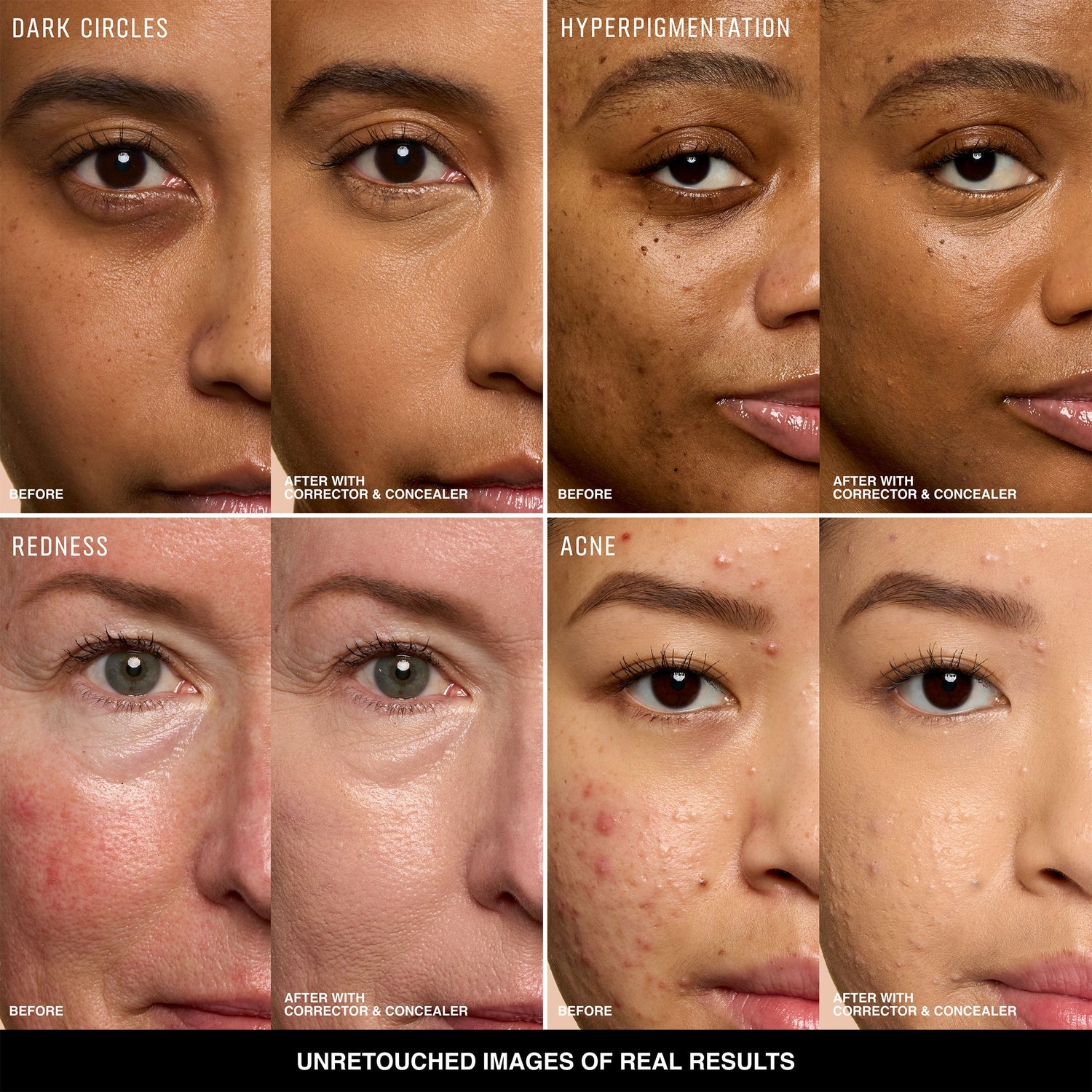 Erase dark circles & blemishes instantly